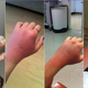 Image for article titled Why Cat Bites Are Pretty Much the Worst Thing Ever